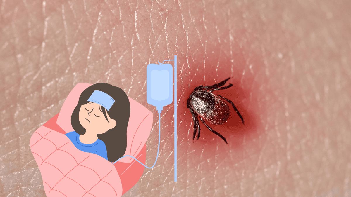 Lyme Disease in Children Symptoms, Diagnosis, and Treatment