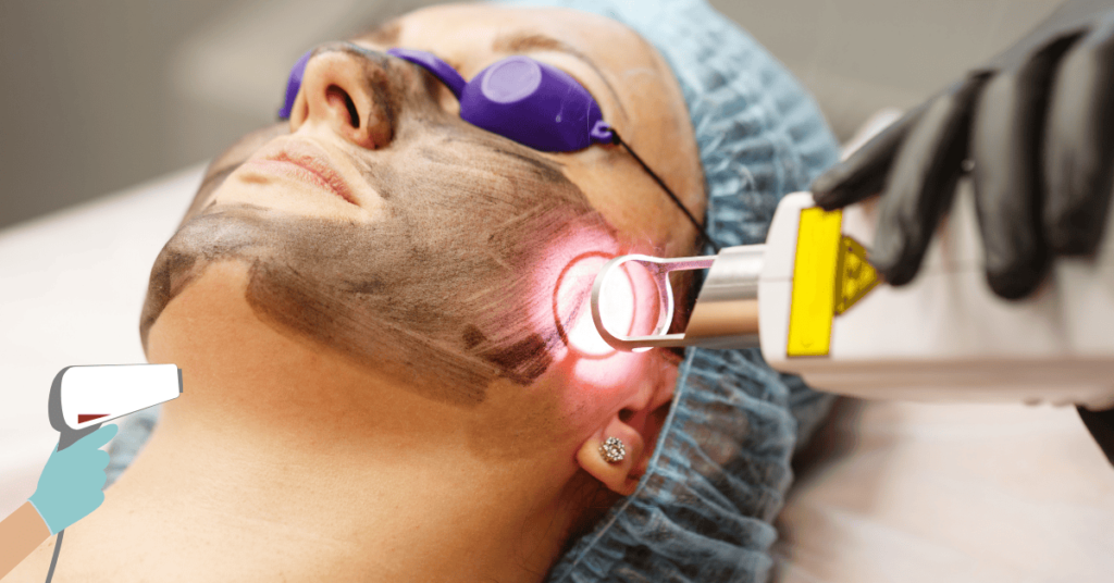 Laser therapy utilizes targeted light energy to break down melanin and reduce hyperpigmented areas. 