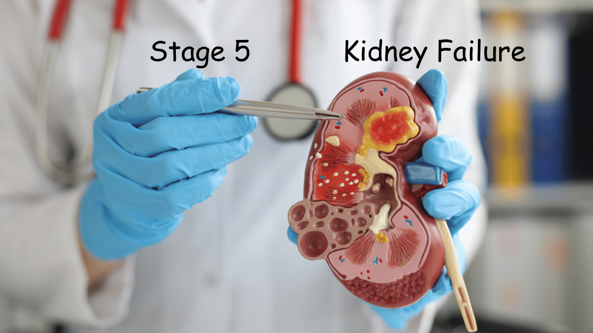 Stage 5 Kidney Failure Symptoms, Causes, and Treatment Options